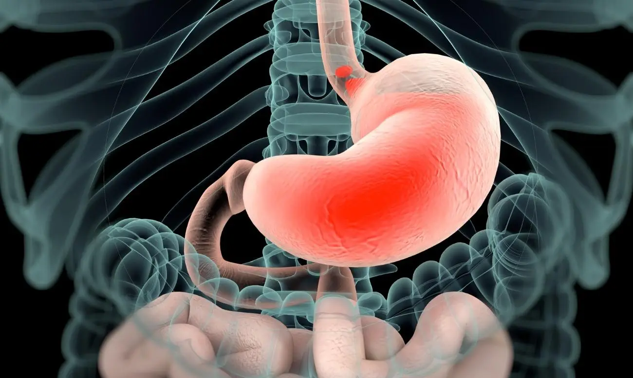 Ecco 3 segnali che indicano un cattivo funzionamento dello stomaco